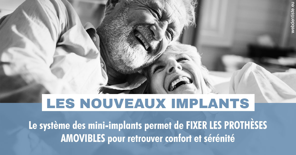 https://www.dr-dudas.fr/Les nouveaux implants 2