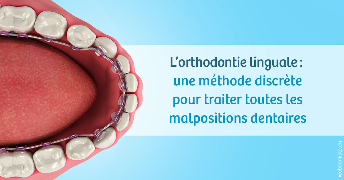 https://www.dr-dudas.fr/L'orthodontie linguale 1