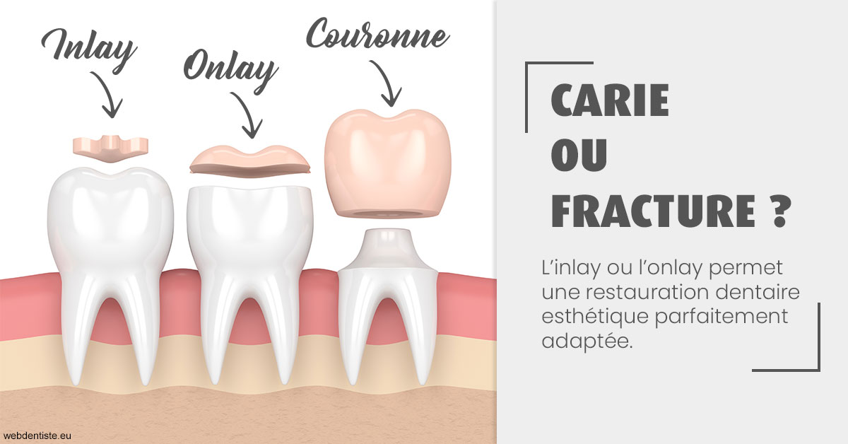 https://www.dr-dudas.fr/T2 2023 - Carie ou fracture 1