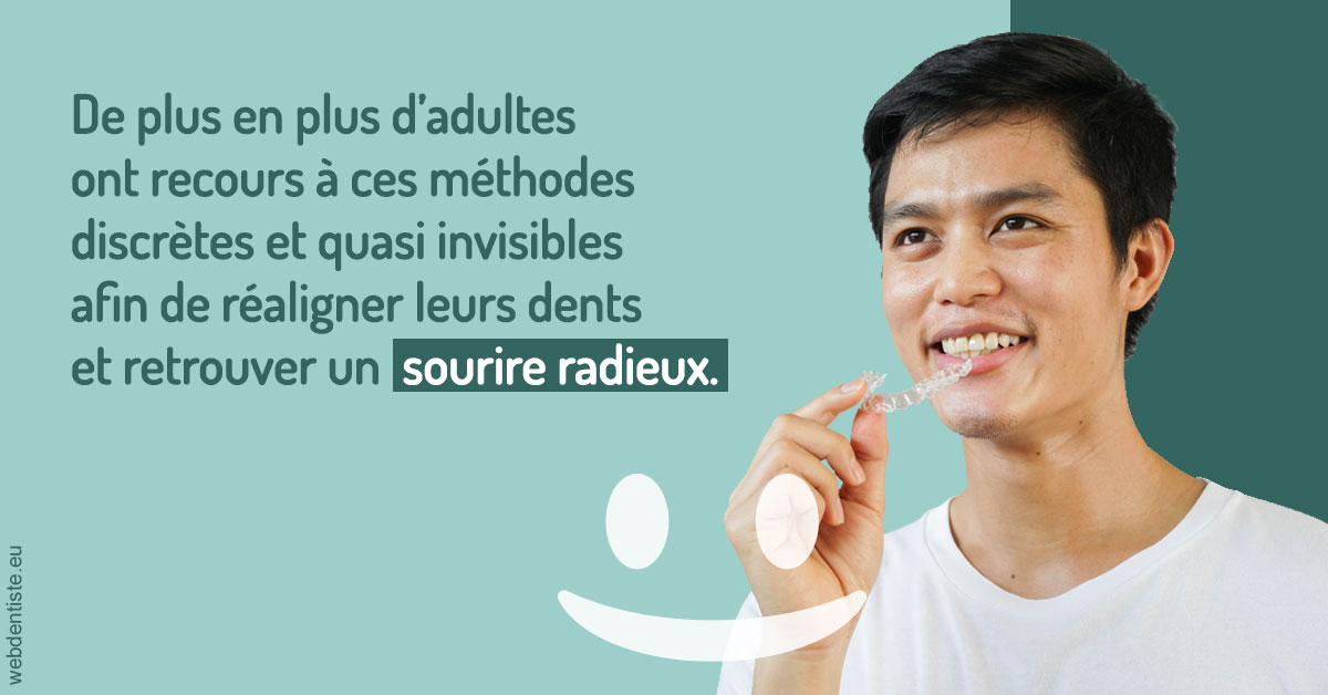 https://www.dr-dudas.fr/Gouttières sourire radieux 2