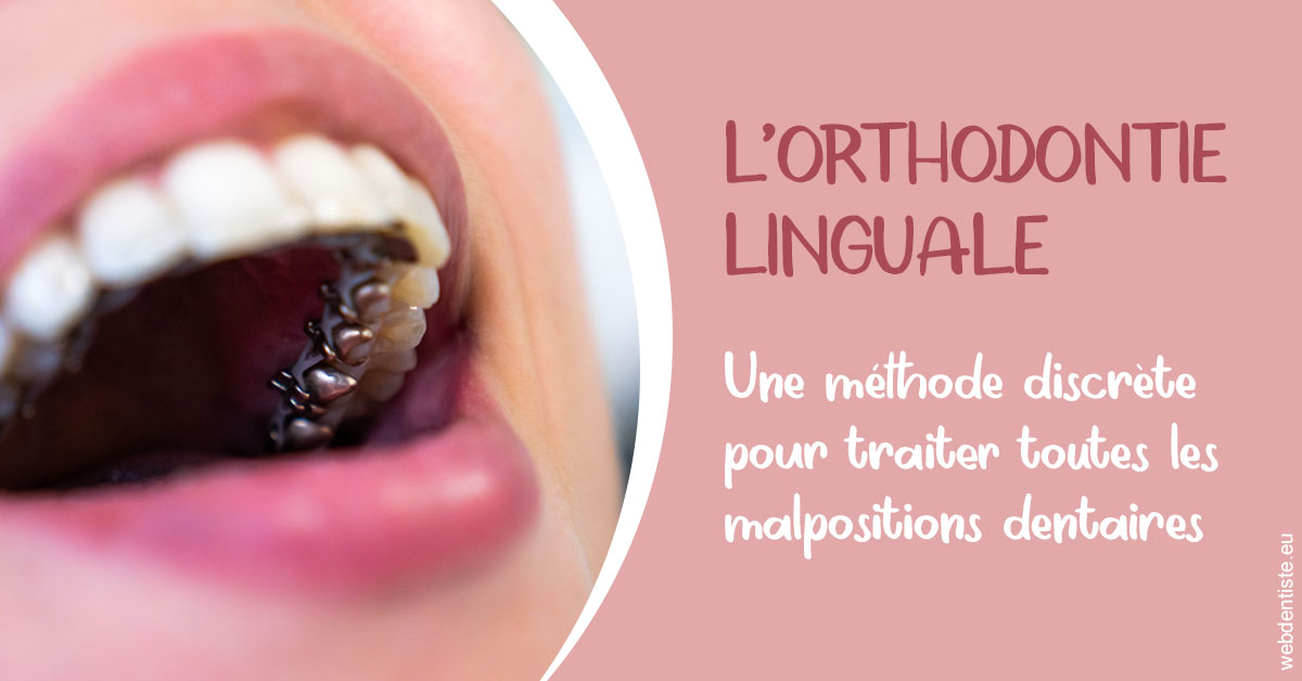 https://www.dr-dudas.fr/L'orthodontie linguale 2