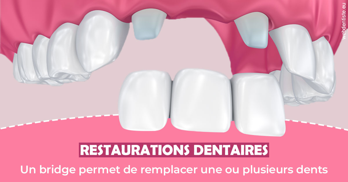 https://www.dr-dudas.fr/Bridge remplacer dents 2