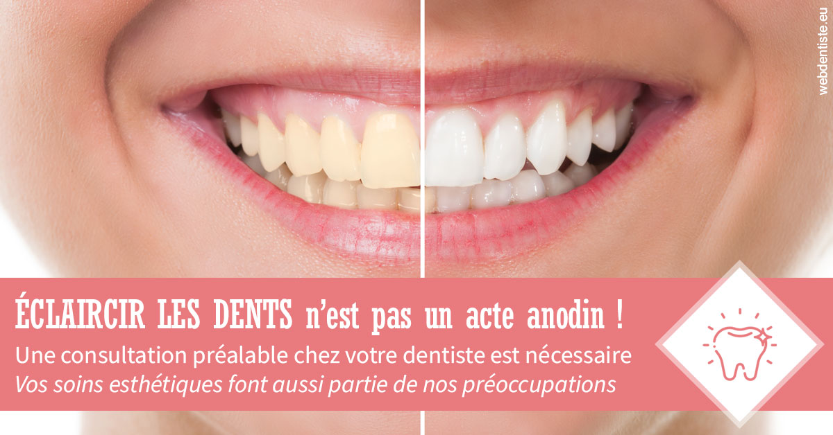 https://www.dr-dudas.fr/Eclaircir les dents 1
