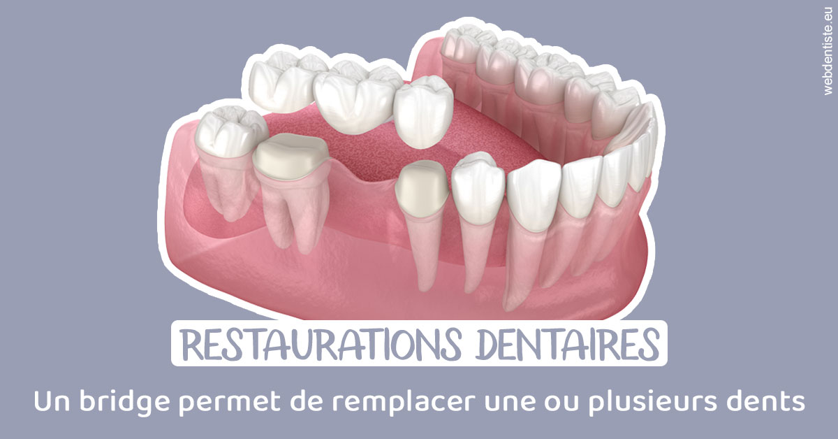 https://www.dr-dudas.fr/Bridge remplacer dents 1