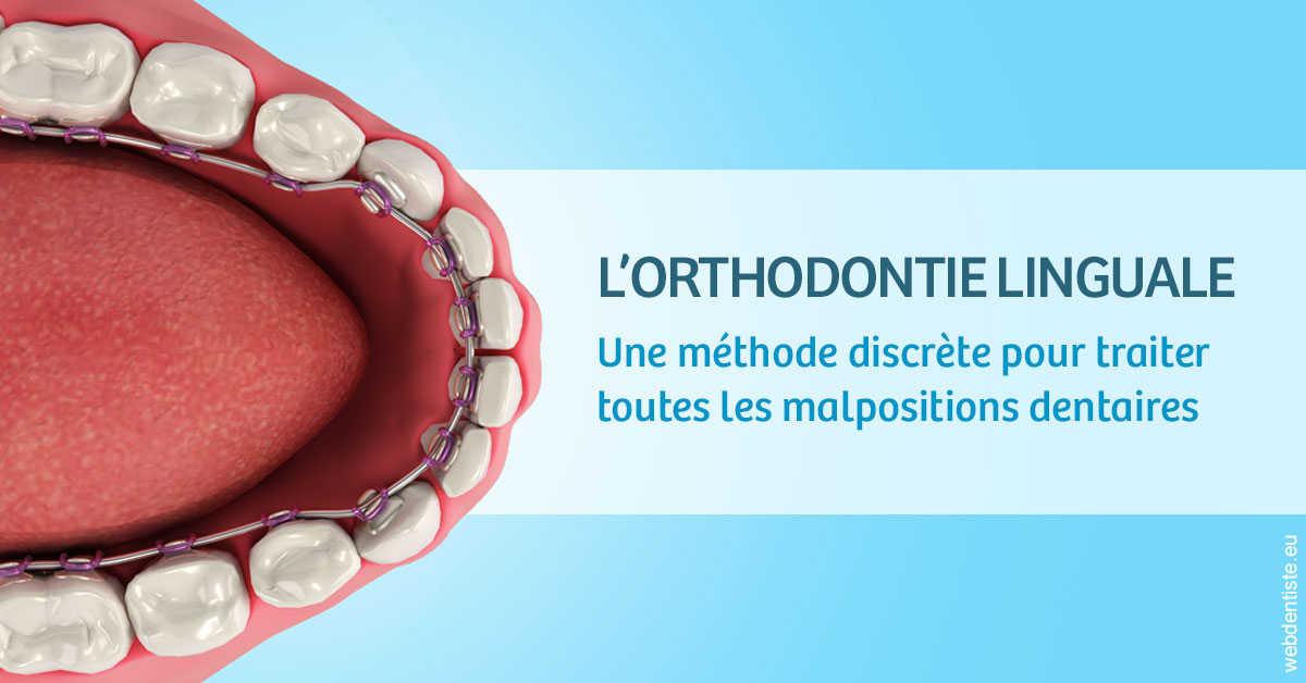 https://www.dr-dudas.fr/L'orthodontie linguale 1