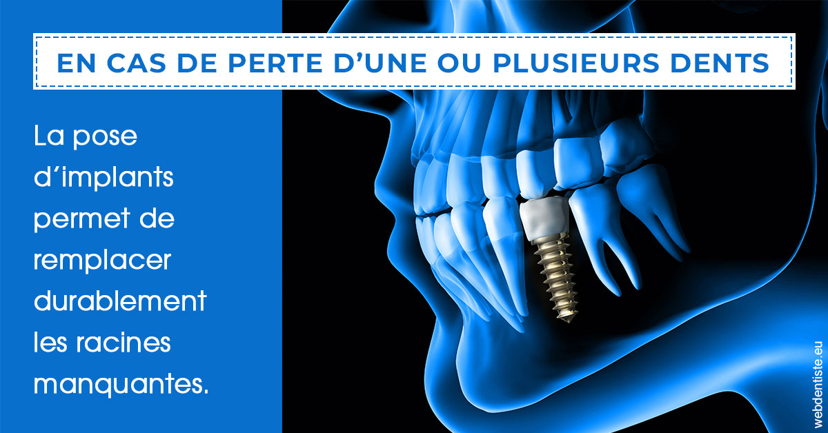 https://www.dr-dudas.fr/2024 T1 - Implants 01