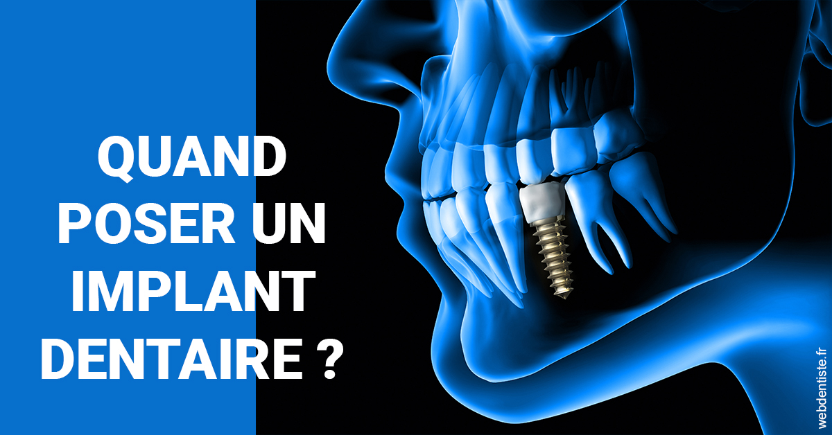 https://www.dr-dudas.fr/Les implants 1