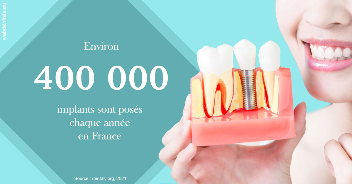 https://www.dr-dudas.fr/Pose d'implants en France 2
