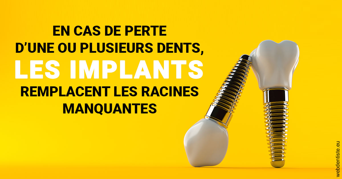 https://www.dr-dudas.fr/Les implants 2