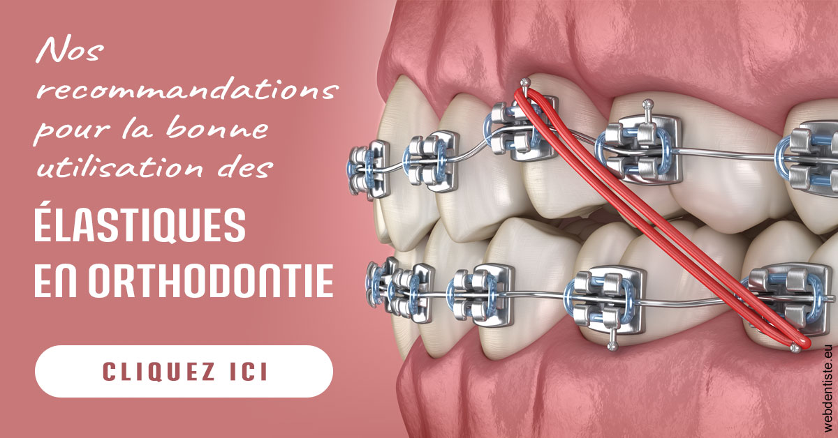 https://www.dr-dudas.fr/Elastiques orthodontie 2
